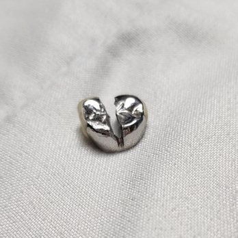 La Dental Boutique - LA Dental Boutique Stainless steel crown that was removed by another dentist (back view) - General Dentistry Near Me - Los Angeles, California La Dental Boutique - LA Dental Boutique Stainless steel crown that was removed by another dentist (back view) - General Dentistry Near Me - Los Angeles, California