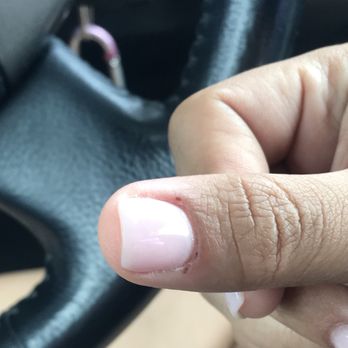 Top City Nails - Bleeding cuticles - Nail Salons Near Me - Riverside, California