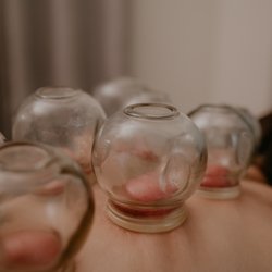 Lanikai Beach Spa - Cupping
