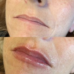 Studio 92 Salon & Spa - LIP INFUSION