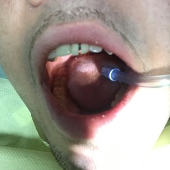Best Dental Center for Dentistry - They cut the shitty crown Dr Rizk aka Dr RISK put in down the middle as I was in great discomfort & pain in this tooth. It's a new crown wtf - Cosmetic Dentists Near Me - Brooklyn, New York Best Dental Center for Dentistry - They cut the shitty crown Dr Rizk aka Dr RISK put in down the middle as I was in great discomfort & pain in this tooth. It's a new crown wtf - Cosmetic Dentists Near Me - Brooklyn, New York