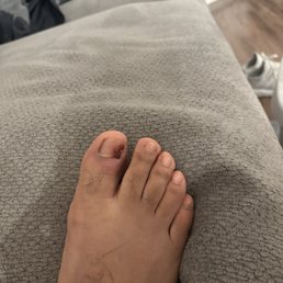 Couple of days after having a pedicure at VIP NAILS Couple of days after having a pedicure at VIP NAILS