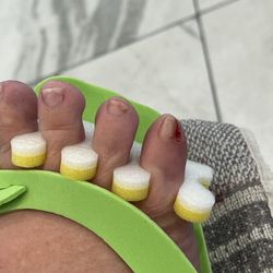 Q Nails - This shows the bleeding before polish applied.