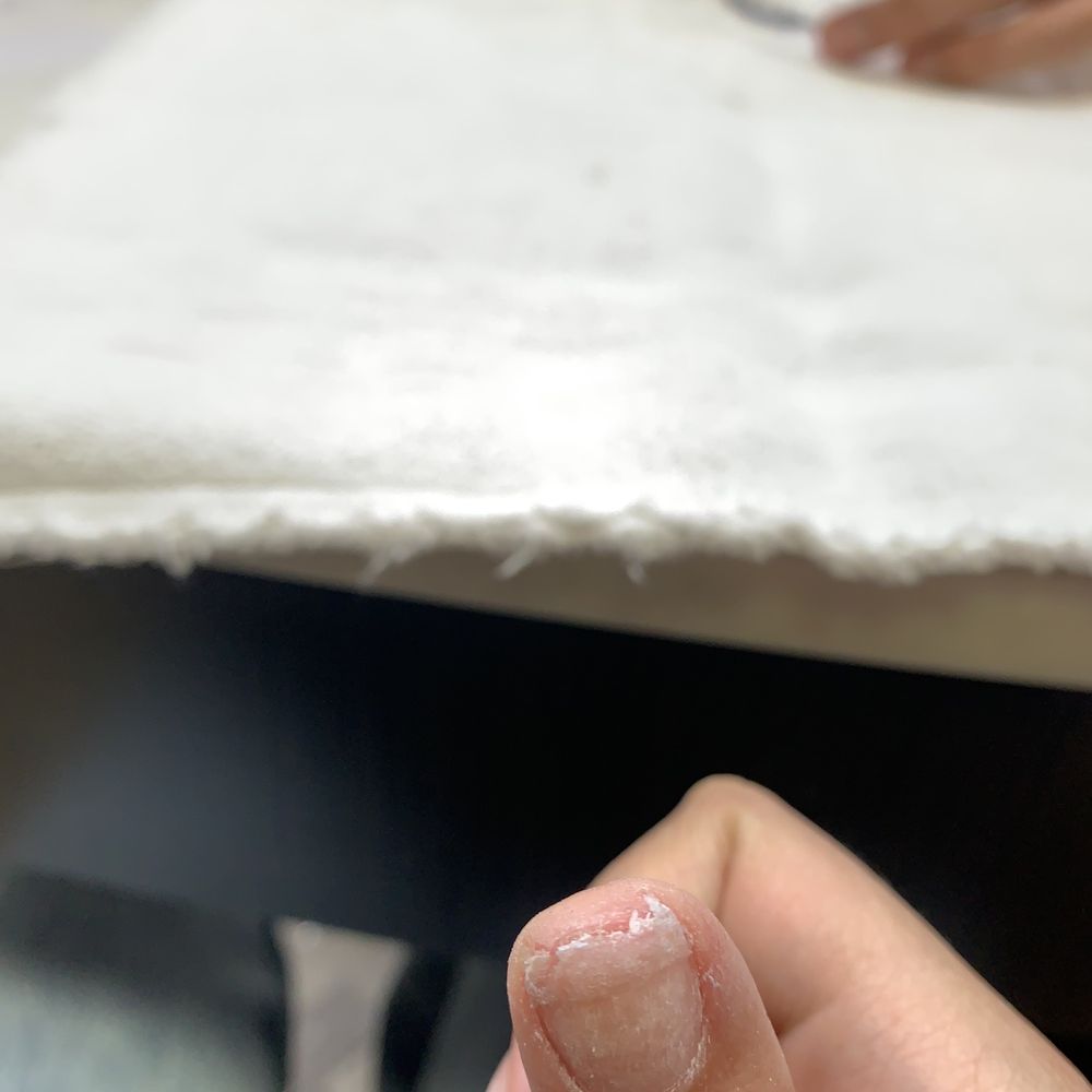Love Nail Spa - how my nail was left by this salon - Nail Salons Near Me - Downey, California Love Nail Spa - how my nail was left by this salon - Nail Salons Near Me - Downey, California