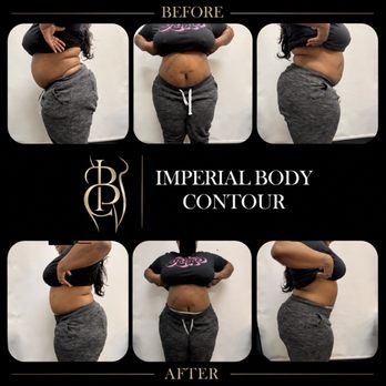 Imperial Body Contour - Body Contouring Near Me - Fontana, California Imperial Body Contour - Body Contouring Near Me - Fontana, California