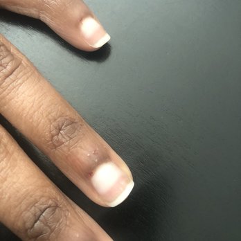 Grand Nails Bar - Cuts on ring and pinky finger - Nail Salons Near Me - Richmond, Texas Grand Nails Bar - Cuts on ring and pinky finger - Nail Salons Near Me - Richmond, Texas
