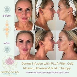Nirvana Wellness & MedSpa