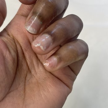 Oasis Nail Spa - Damaged and broken nails - Nail Salons Near Me - Pearland, Texas Oasis Nail Spa - Damaged and broken nails - Nail Salons Near Me - Pearland, Texas