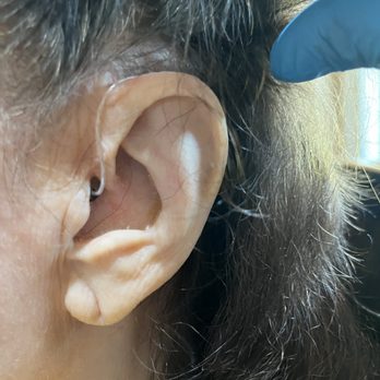 Hear Now - RIC-R very discreet style - Hearing Aid Providers Near Me - Gretna, Louisiana Hear Now - RIC-R very discreet style - Hearing Aid Providers Near Me - Gretna, Louisiana