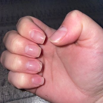Queen Nails & Spa - Lifting & cracked nails because they are so thin. Instead of Building the name they apply just like regular gel polish - Nail Salons Near Me - Phoenix, Arizona