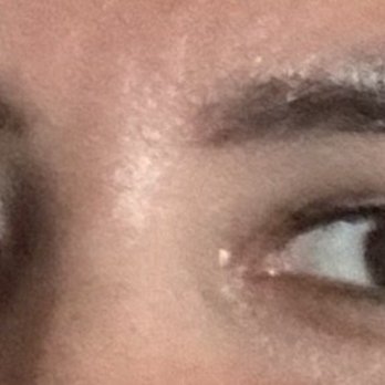 Devereux Beauty - What she started with... no shape fuzzy brows - Eyebrow Services Near Me - Petaluma, California Devereux Beauty - What she started with... no shape fuzzy brows - Eyebrow Services Near Me - Petaluma, California