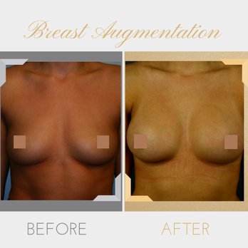 Leo Lapuerta, MD - Cosmetic Surgeons Near Me - Houston, Texas Leo Lapuerta, MD - Cosmetic Surgeons Near Me - Houston, Texas