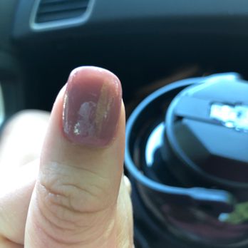 Kims Nail Salon - The rough spots and appearance of dents - Nail Salons Near Me - Madison, Alabama Kims Nail Salon - The rough spots and appearance of dents - Nail Salons Near Me - Madison, Alabama