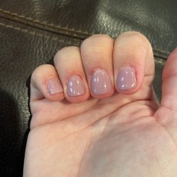 Photo of the dried blood around every. Single. One. Of. My. Nails.