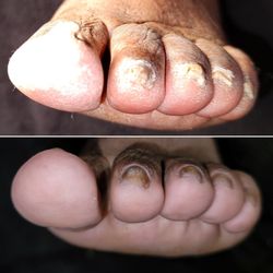 Hygeian Hand and Foot Refinery PLLC