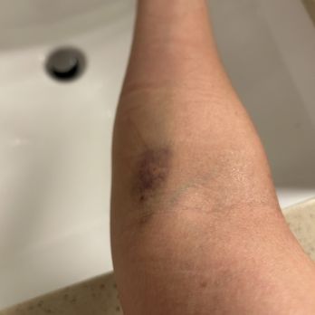 QUEST DIAGNOSTICS - Updated January 2025 - 30 Photos & 73 Reviews