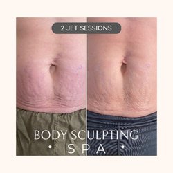 Body Sculpting Academy - Jet plasma