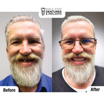 Smile Stop Dentures & Implants - General Dentistry Near Me - Tulsa, Oklahoma Smile Stop Dentures & Implants - General Dentistry Near Me - Tulsa, Oklahoma