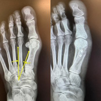 Lakeland Foot and Ankle - Dr. William S Wong, DPM, FACFAS - Podiatrists Near Me - Lakeland, Florida Lakeland Foot and Ankle - Dr. William S Wong, DPM, FACFAS - Podiatrists Near Me - Lakeland, Florida