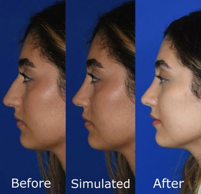 The Seattle Facial Plastic Surgery Center