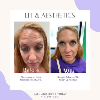 LIT & Aesthetics Spa - Medical Spas Near Me - Cypress, Texas LIT & Aesthetics Spa - Medical Spas Near Me - Cypress, Texas