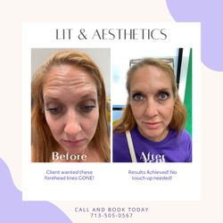 LIT & Aesthetics Spa