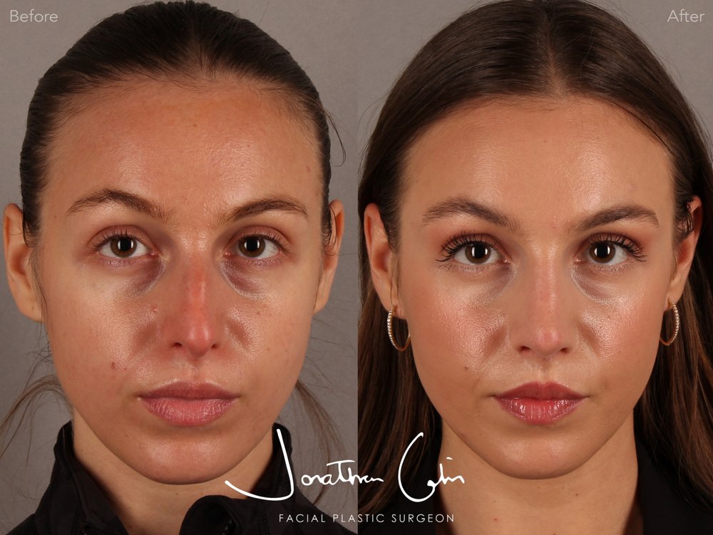 Jonathan Cabin, MD - Facial Plastic Surgery Logo