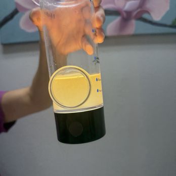 Admired Radiance - This was in my skin removed from the hydrafacial. - Day Spas Near Me - Honolulu, Hawaii