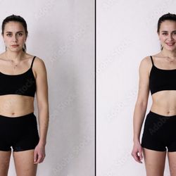 Dreambody Contouring - Before and after