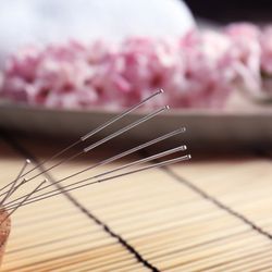 Traditional Oriental Medicine