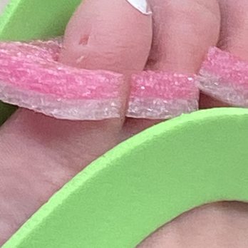 Foxy Nails - After he put a crap ton of alcohol on it to stop the bleeding. Not pictured are the copious amounts of cuts on the bottom of my feet too. - Nail Salons Near Me - Madison Heights, Virginia