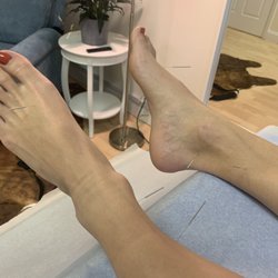 Lifestyle Acupuncture