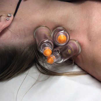 Central Coast Red Coral Spa - Body cupping. For pain relief, and helping to lift and move stagnation within the body so the body can heal and function better! - Skin Care Near Me - Arroyo Grande, California Central Coast Red Coral Spa - Body cupping. For pain relief, and helping to lift and move stagnation within the body so the body can heal and function better! - Skin Care Near Me - Arroyo Grande, California