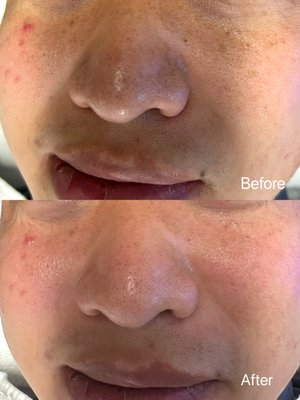 Beverly Hills Rejuvenation Center Westlake Village by null