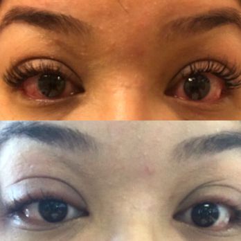 V Spa & Nail Studio - Now I have to go to the doctor to see if there are any damages to my eyes. Lids are swollen and still have redness in the bottom. - Day Spas Near Me - Waldorf, Maryland