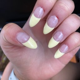 Destroyed cuticles Destroyed cuticles