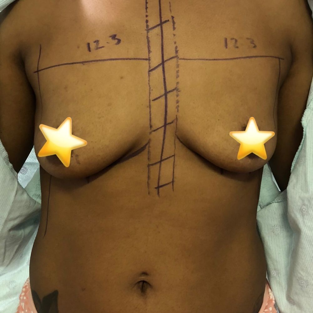 Iconic Plastic Surgery - Before - Cosmetic Surgeons Near Me - Carlsbad, California Iconic Plastic Surgery - Before - Cosmetic Surgeons Near Me - Carlsbad, California