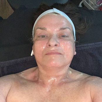 Shameless Aesthetics - DMK Enzyme Treatment - Skin Care Near Me - Cumming, Georgia