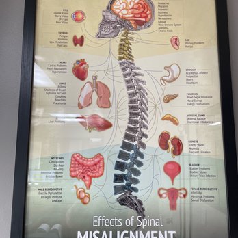 Back to Action Chiropractic - Effects of Spinal Misalignment! - Chiropractors Near Me - Tustin, California Back to Action Chiropractic - Effects of Spinal Misalignment! - Chiropractors Near Me - Tustin, California