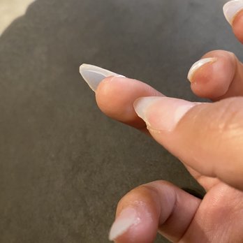 The World Nails & Spa - Notice the chunks of acrylic under the nails - Nail Salons Near Me - Lafayette, Indiana The World Nails & Spa - Notice the chunks of acrylic under the nails - Nail Salons Near Me - Lafayette, Indiana