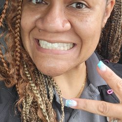 10 years and I'm still smiling and showing off my teeth