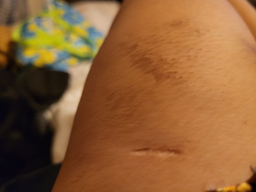 NYC HEALTH + HOSPITALS/QUEENS Updated September 2024 45 Photos & 71 Reviews 8268 164th St