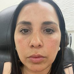 This is me right before the treatment in the treatment room This is me right before the treatment in the treatment room