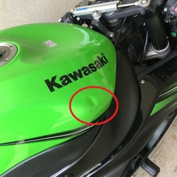 dent dent