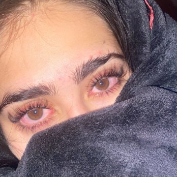 Cree Violet Beauty - (eyes red from lack of sleep)  taken weeks after lift* - Skin Care Near Me - Los Angeles, California