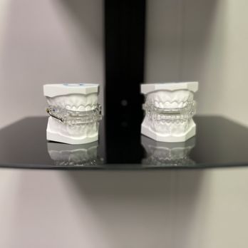 Snoring and Sleep Solutions - Oral appliances we use - Sleep Specialists Near Me - Las Vegas, Nevada Snoring and Sleep Solutions - Oral appliances we use - Sleep Specialists Near Me - Las Vegas, Nevada