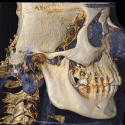 Maxillo-Facial 3D du Grand Montréal