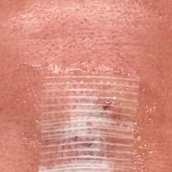 California Dermatology and Mohs Surgery Specialists