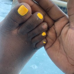 Fucked up toes