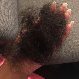 Some of the shedding after washing the hair.